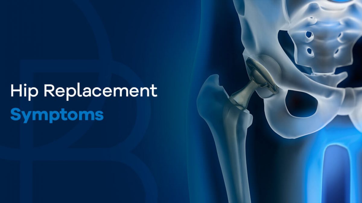 8 Signs To Know If You Need Hip Replacement Surgery