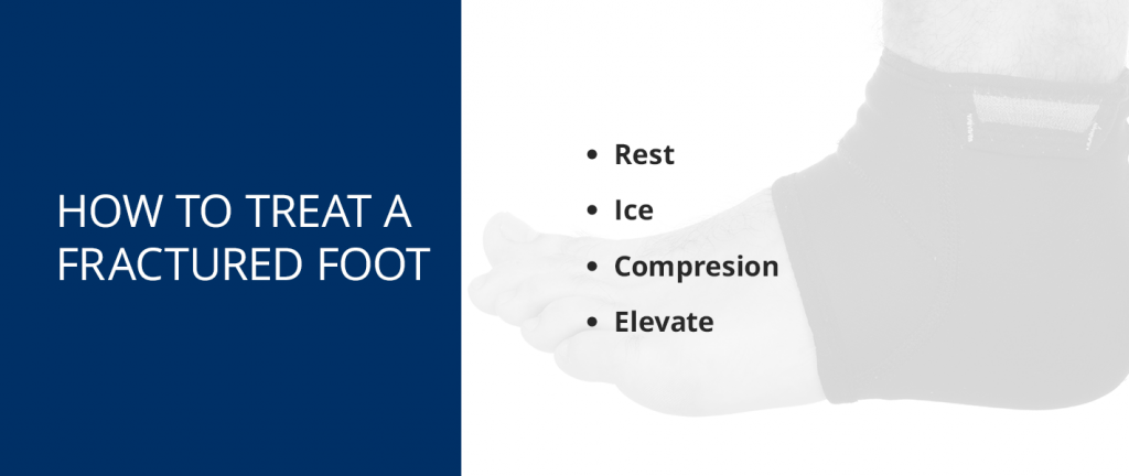 How to Treat a Fractured Foot