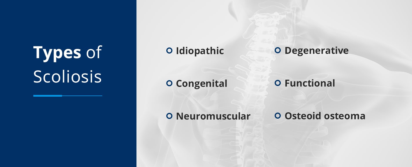 the 6 types of scoliosis