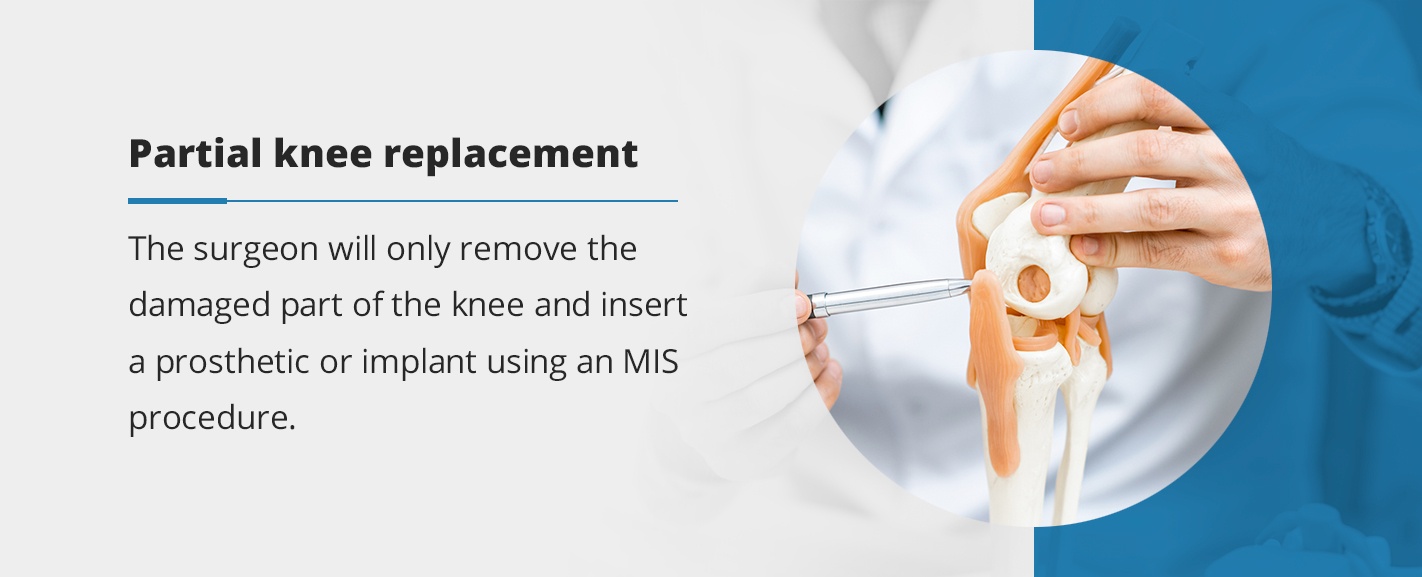 partial knee replacement to treat knees