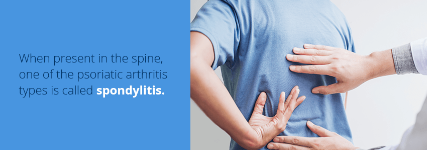 spondylitis arthritis pain