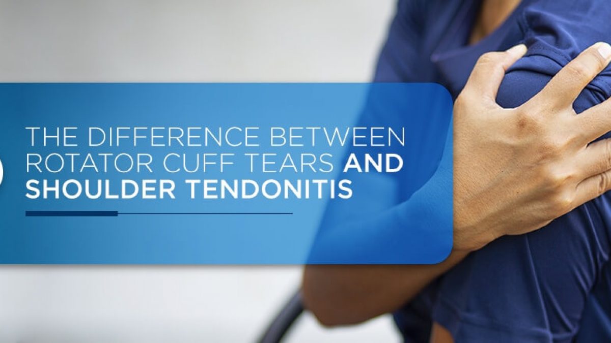 The Difference Between Rotator Cuff Tears & Shoulder Tendonitis