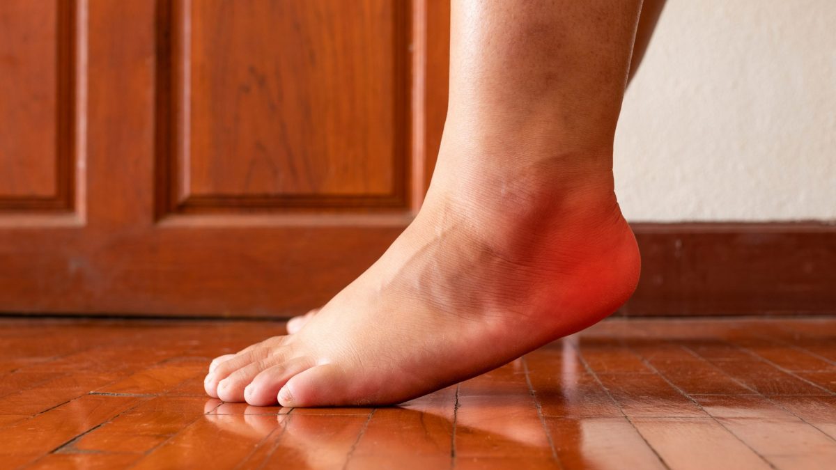 How You Can Treat Plantar Fasciitis at 