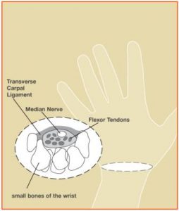 carpal tunnel wrist diagram