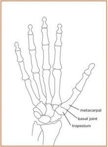 basal joint treatment diagram