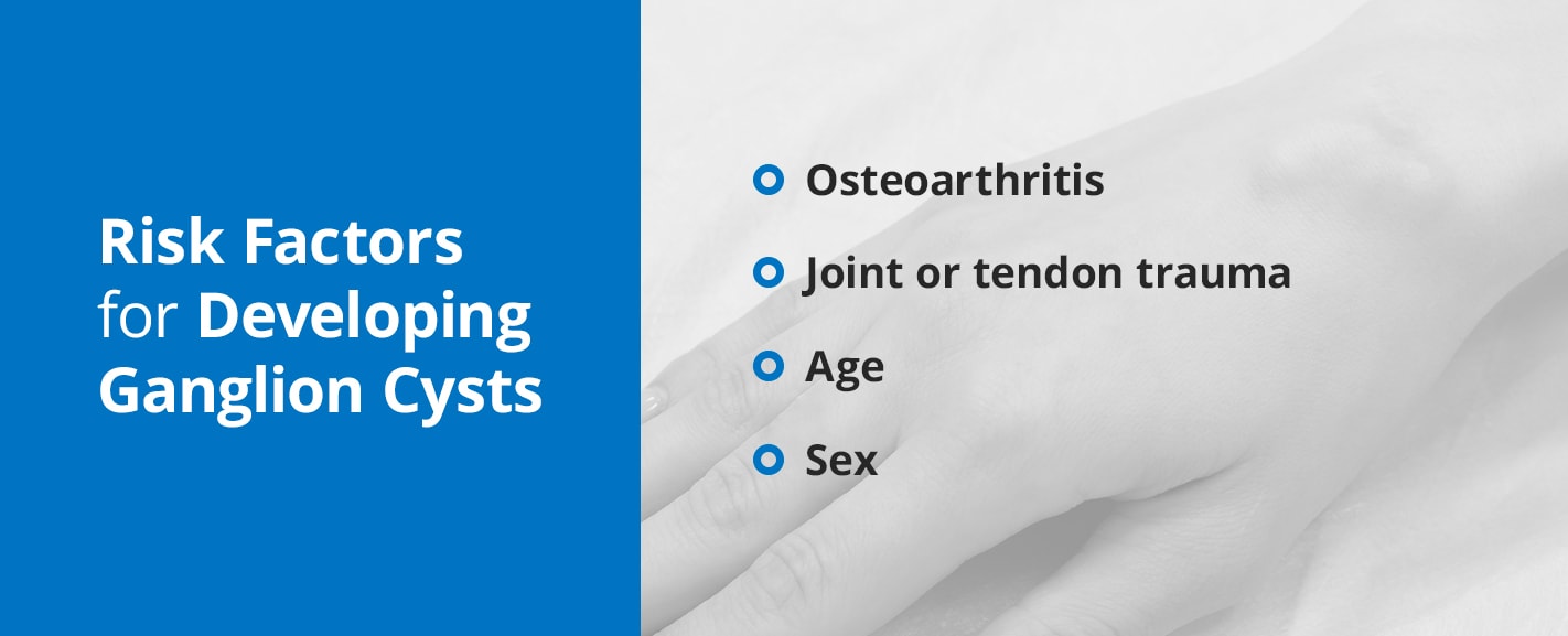 risk factors for developing gangion cysts