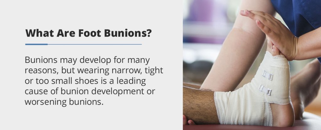 What Are Foot Bunions