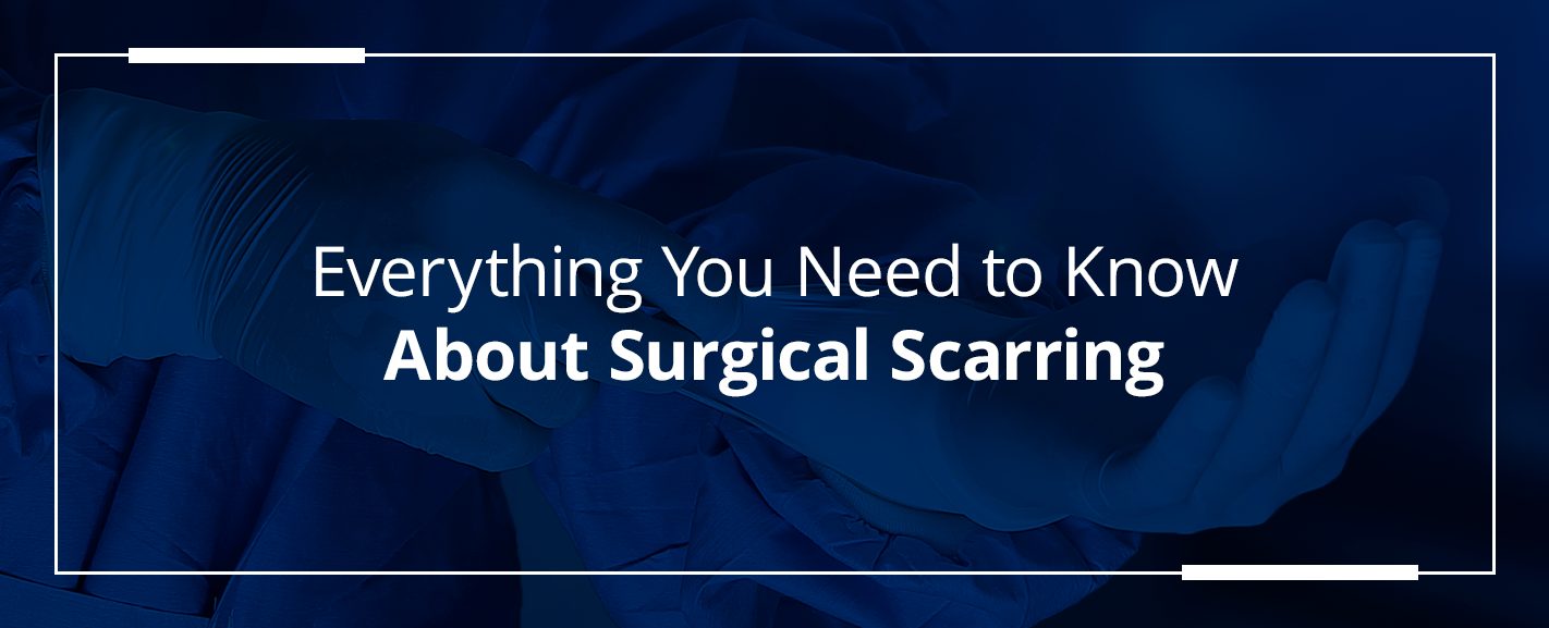 everything you need to know about surgical scarring