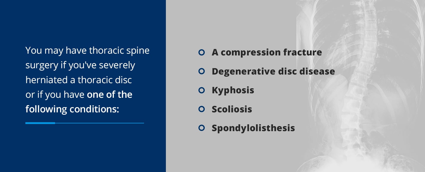 you may have thoracic spine surgery if you've severely herniated a thoracic disc or if you have one of the following conditions