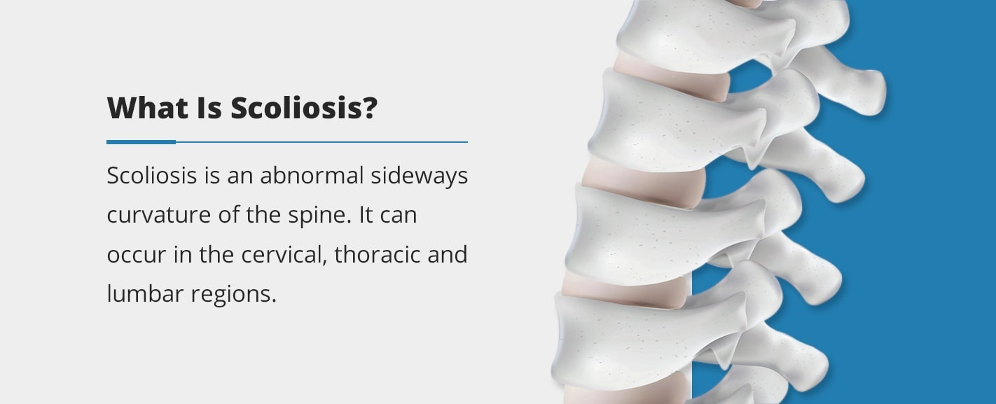 What Is Scoliosis what is scoliosis