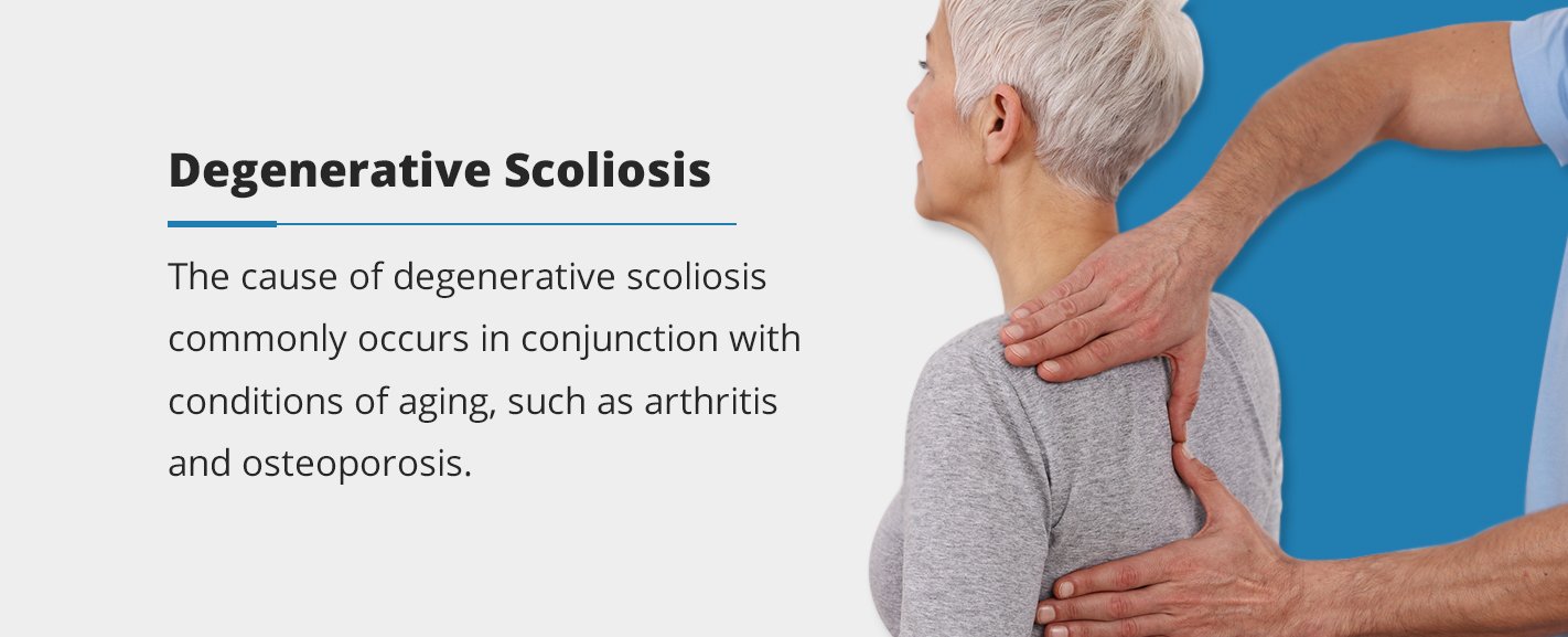 Cause of Scoliosis the cause of degenerative scoliosis