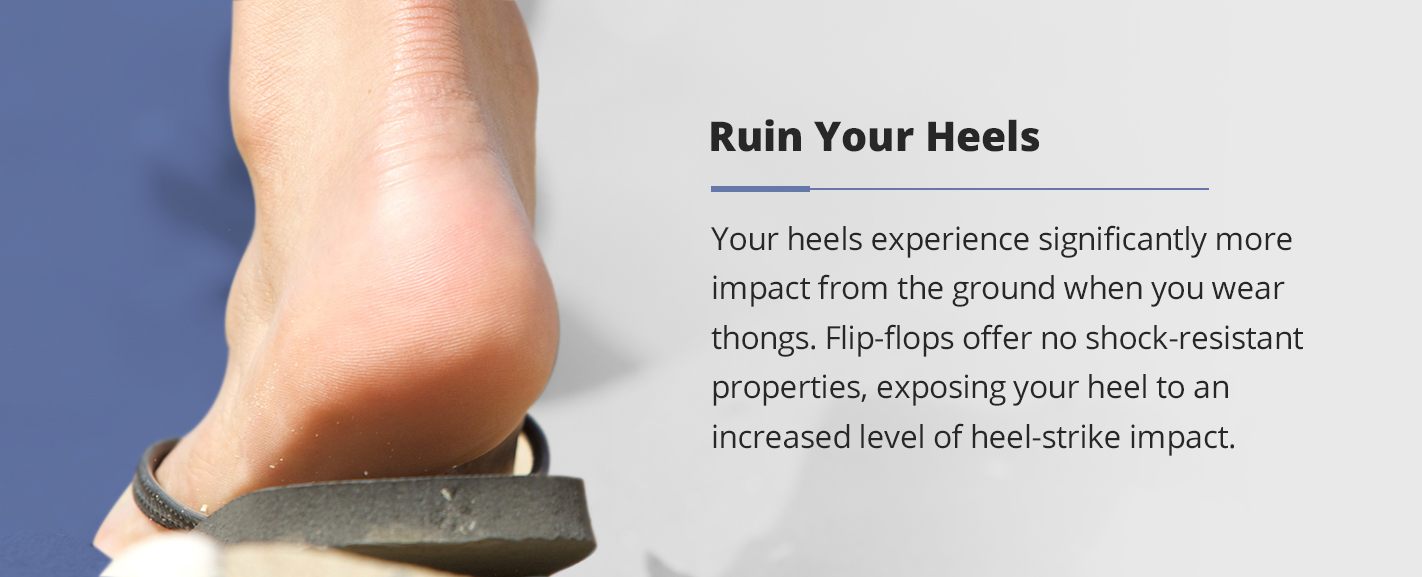 Flip Flops Will Ruin Your Heels how flip flops will ruin your heels