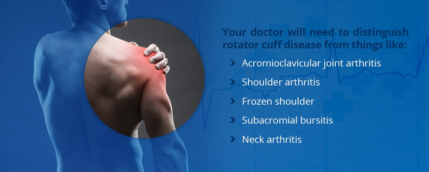 Distinguishing Rotator Cuff Tears From Other Conditions how to distinguish a rotator cuff tear