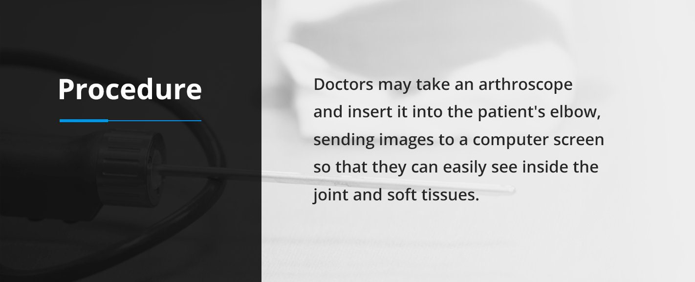 Procedure tommy john surgery procedure