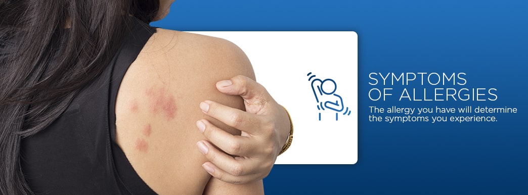 symptoms of allergies