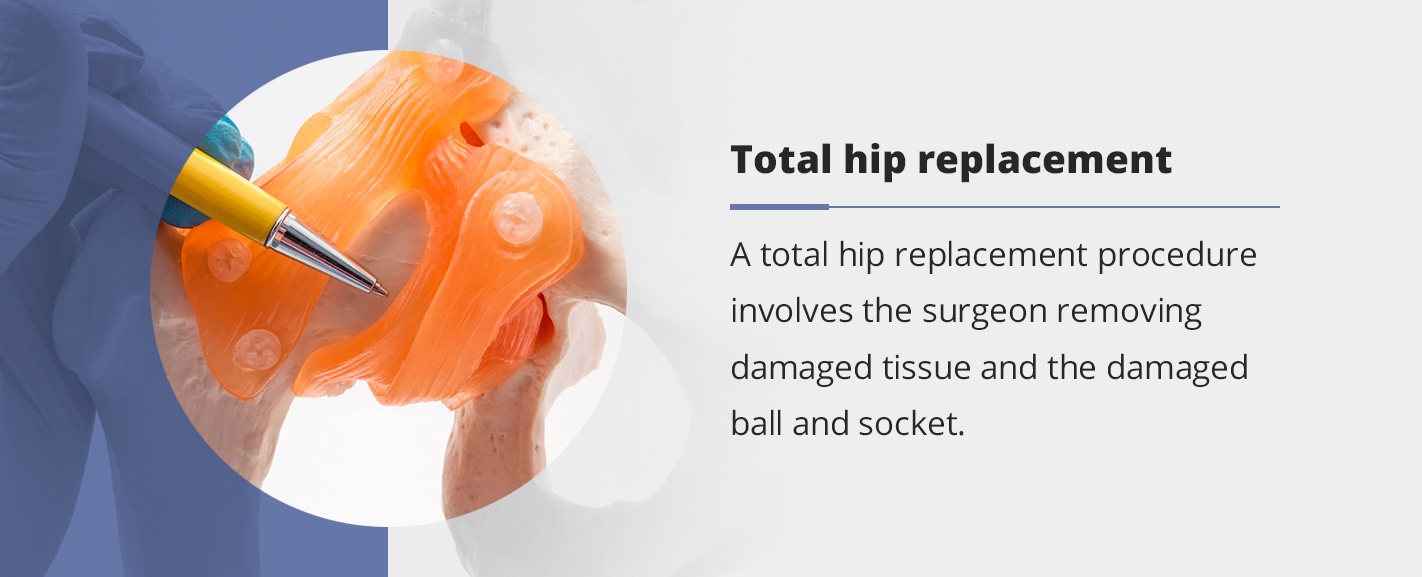 total hip replacement information