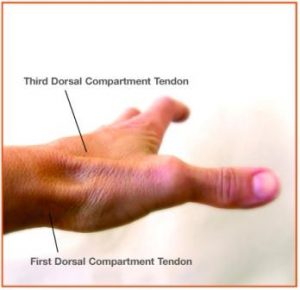 dorsal compartment tendons