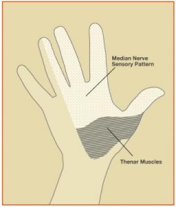 carpal tunnel hand diagram