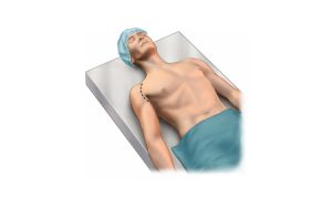 shoulder-joint-exposed