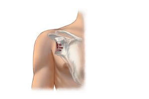socket-preparedfor-implant