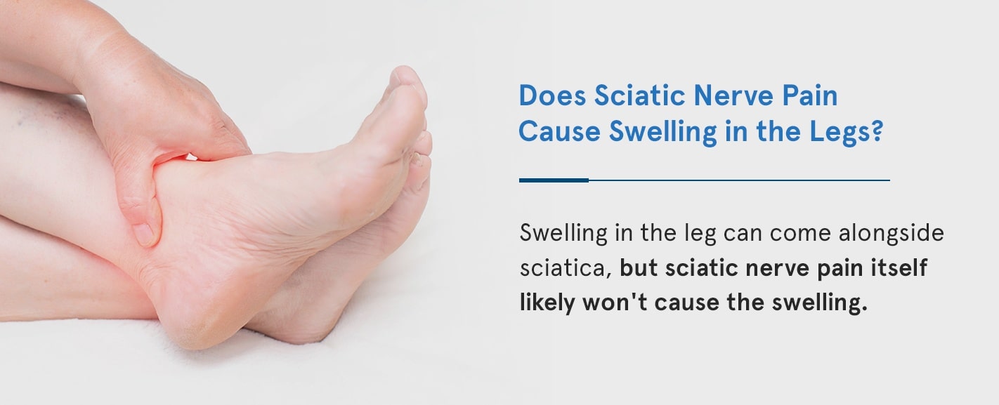 Does Sciatic Nerve Pain Cause Swelling in the Legs swelling in the leg can come alongside sciatica, but sciatic nerve pain itself likely won't cause the swelling