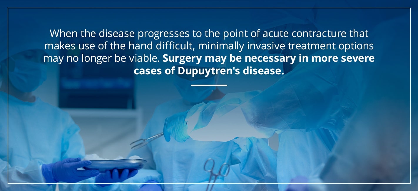surgery may be necessary in more severe cases of dupuytren's disease