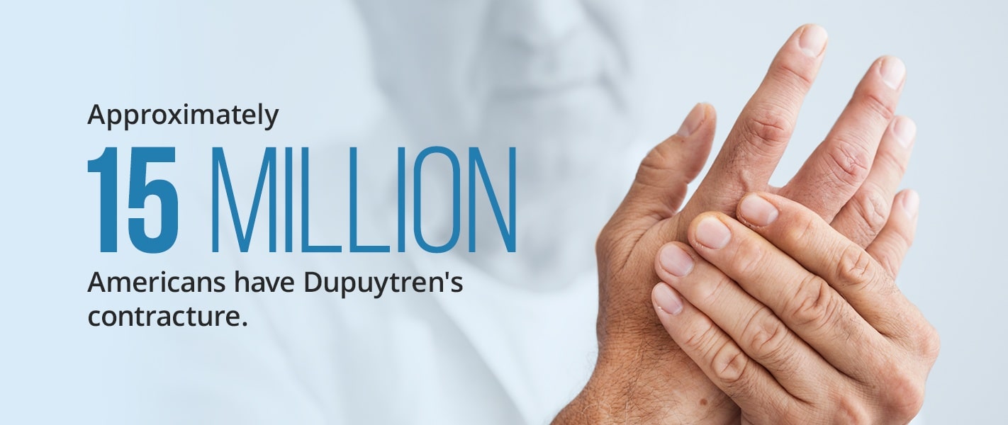 approximately 15 million americans have dupuytren's contracture