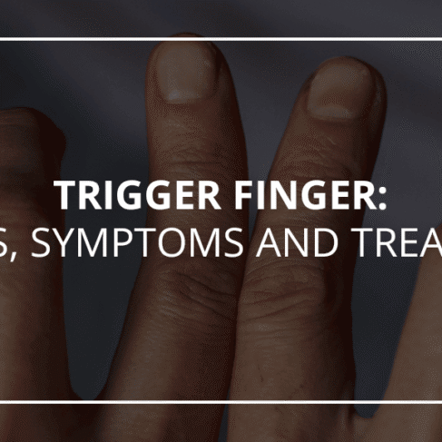 Trigger Finger: Causes, Symptoms, &amp; Treatment | OrthoBethesda