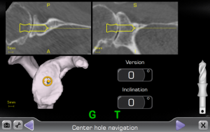 How Dr. Craig Miller Uses New Technology to Improve Shoulder Surgery