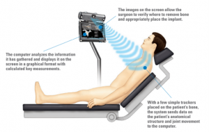How Dr. Craig Miller Uses New Technology to Improve Shoulder Surgery