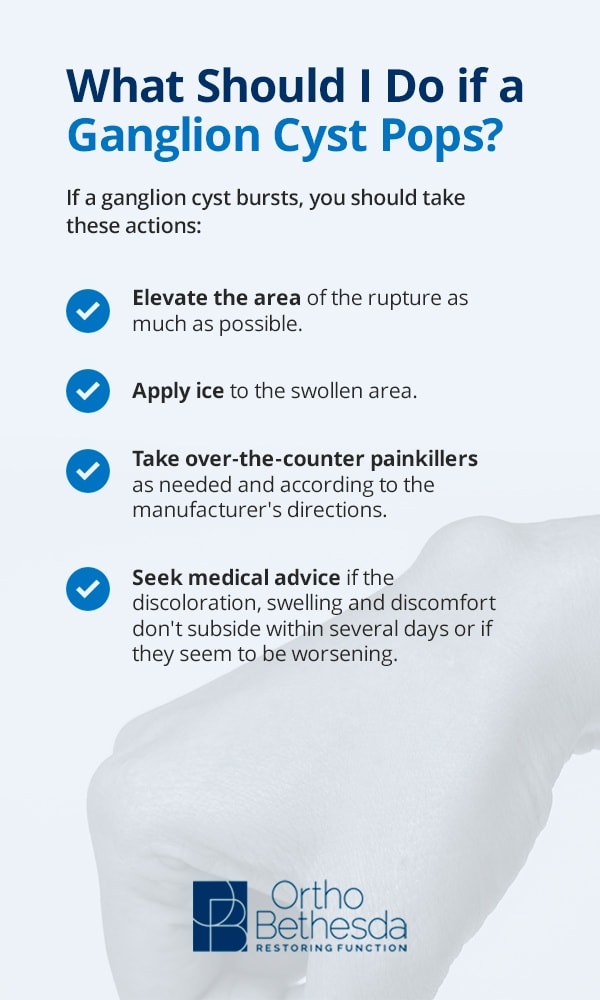 what to do if a ganglion cyst pops