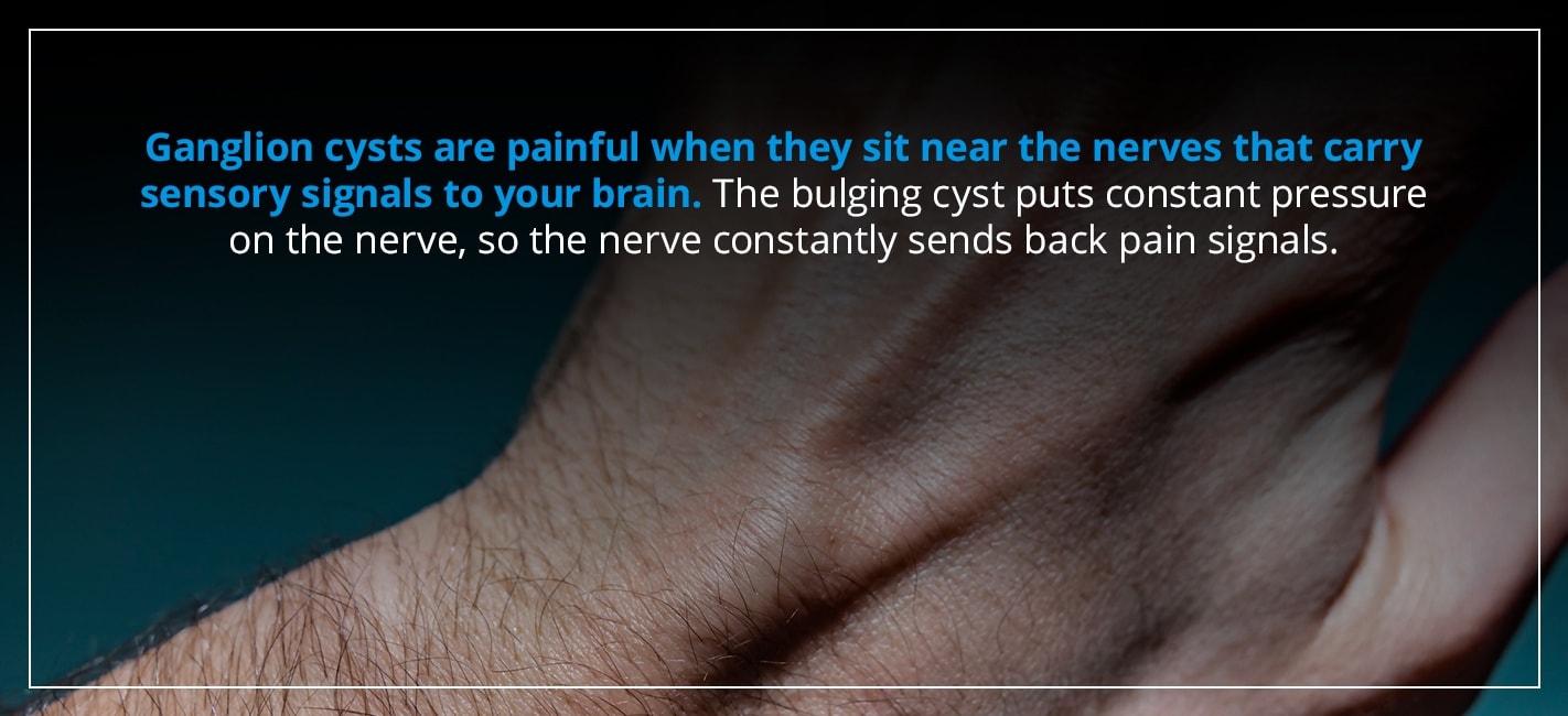 ganglion cysts are painful when they sit near the nerves that carry sensory signals to your brain