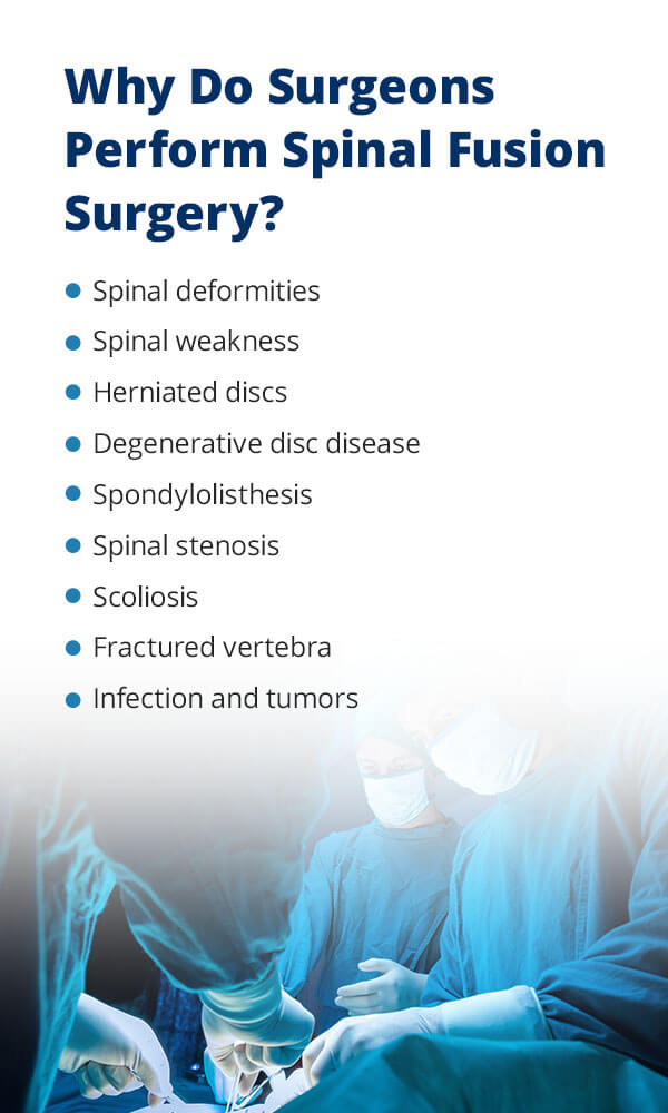 Why Do Surgeons Perform Spinal Fusion Surgery