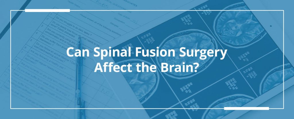 Spinal Fusion Surgery And the Brain