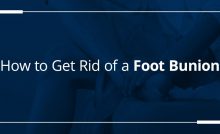 How to Get Rid of a Foot Bunion