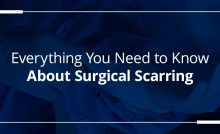 everything you need to know about surgical scarring